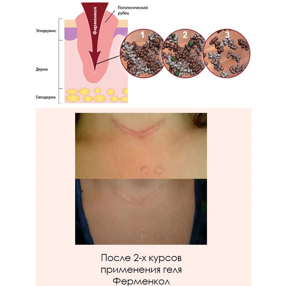 Ферменкол гель туба 30 г.