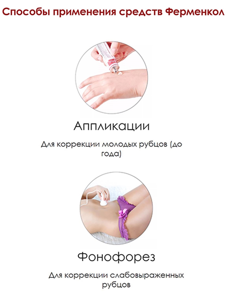 Ферменкол гель туба 10 г.