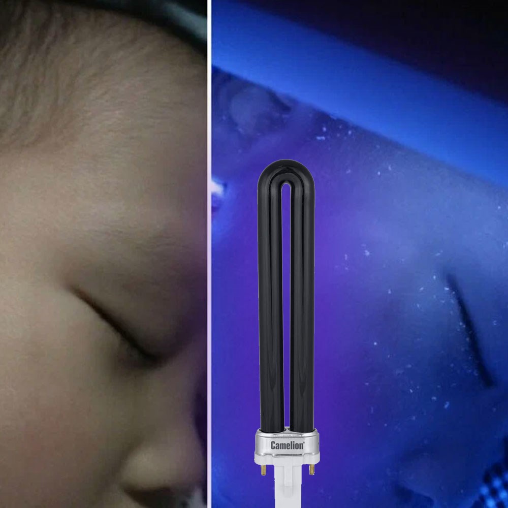 Готовый набор "Вуда  365" люминесцентный диагностический излучения 365 нм