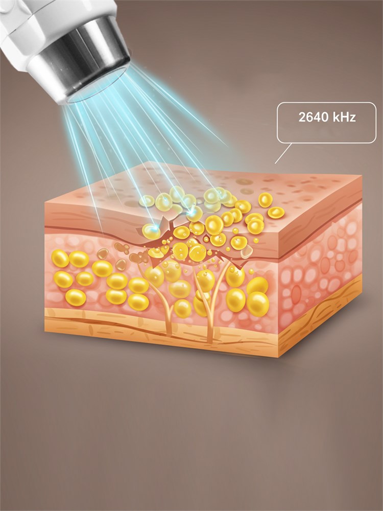 ФизиоФон УЗТ-1.3.07 Ф аппарат физиотерапевтический ультразвуковой