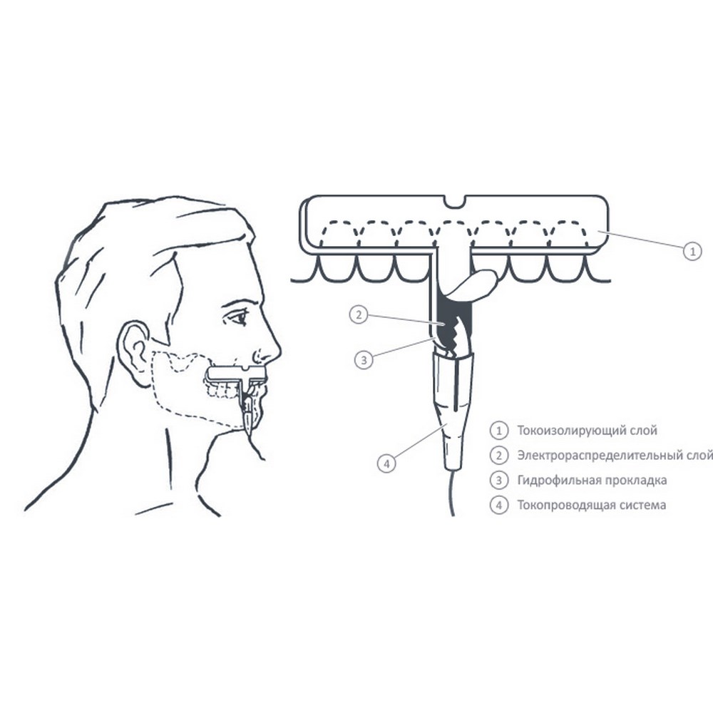 Электрод одноразовый "Десенный" (Т-образный) 110 мм. Цена за упаковку 2 шт. Под зажим "крокодил"