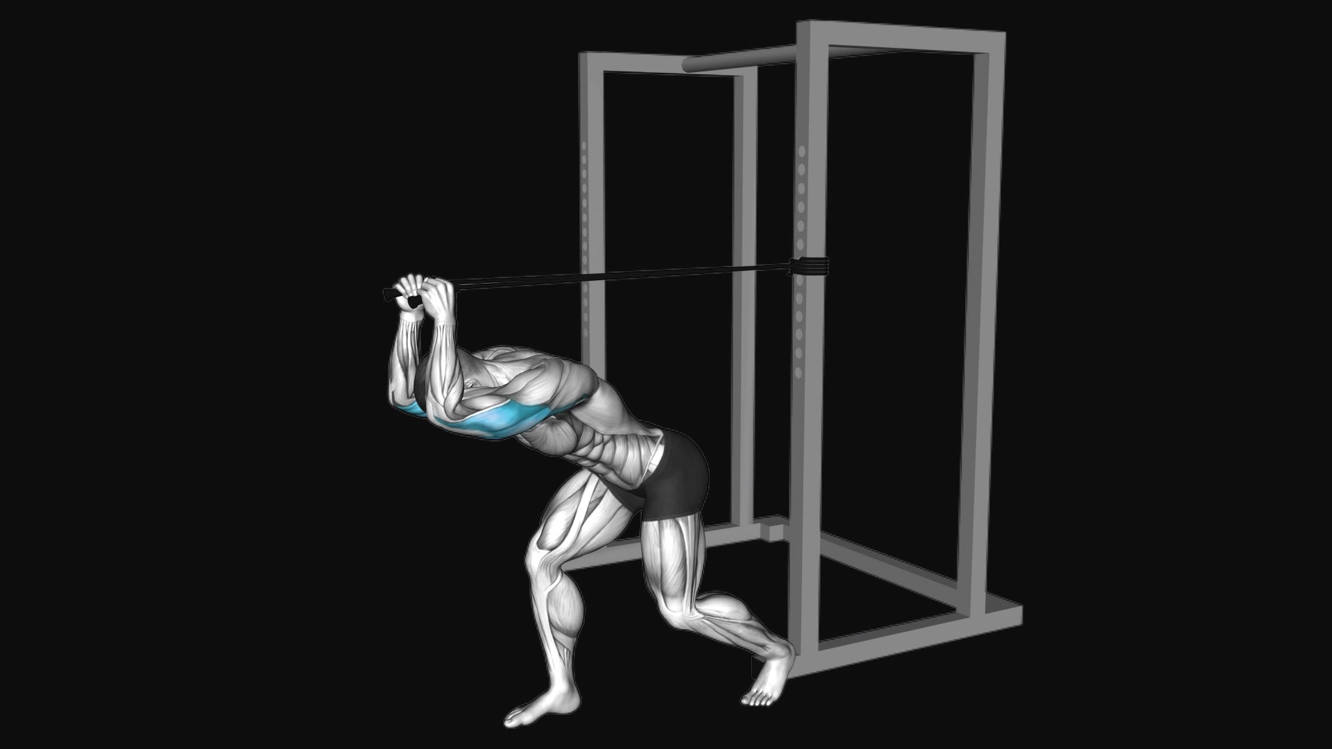 Band High Pulley Overhead Triceps Extension