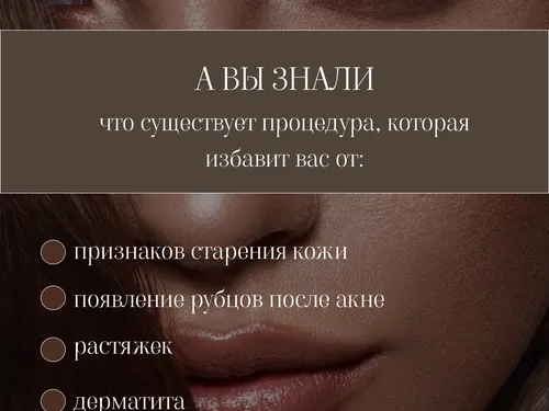Сторителлинг