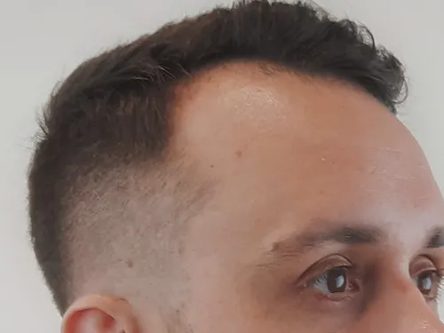 Fade