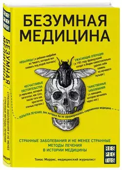 Безумная медицина: Странные заболевания и не менее странные методы лечения в истории медицины