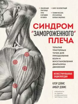 Синдром «замороженного» плеча: Терапия триггерных точек для преодоления боли и восстановления диапазона движений
