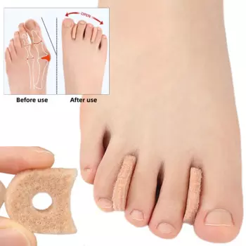 20Pieces Hallux Valgus Feet Care Toe Separators Pedicure Fingers Bunion Straightener Bunion Protector Corrector For Daily Use
