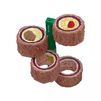 Анатомическая модель атеросклероза и тромбоза PLLCUTE