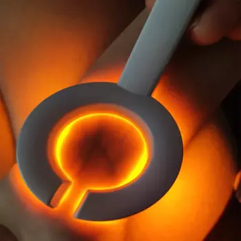 Инфракрасный сканер вен Dreamburgh 110-220 В