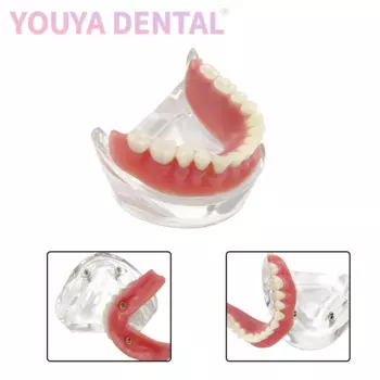 Модель для коррекции имплантации зубов, модель M6002 Overdenture Mandibular Band 2, модели для имплантации ногтей для обучения стоматологии