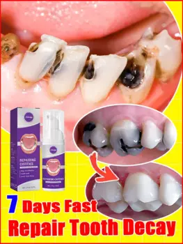 tooth repair