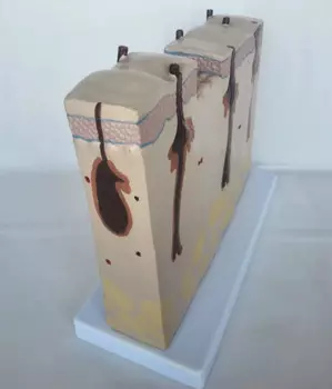 Улучшенная структура волосяного фолликула человеческой кожи, медицинская анатомическая модель для обучения заболеваниям кожи