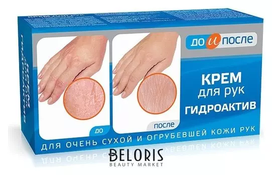 Крем для сухой кожи рук Гидроактив "До и после"
