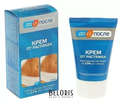 Крем от растяжек