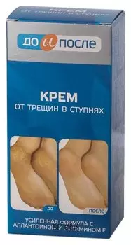 Крем от трещин в ступнях "До и после" (Объем 150 мл)