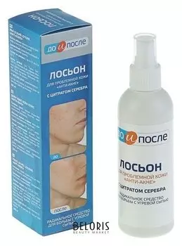 Лосьон для проблемной кожи "До и после Анти-акне"