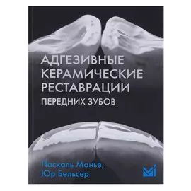 Адгезивные керамические реставрации передних зубов