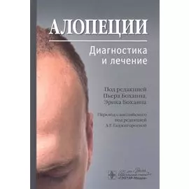 Алопеции. Диагностика и лечение
