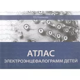 Атлас электроэнцефалограмм детей