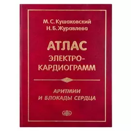 Атлас электрокардиограмм. Аритмии и блокады сердца