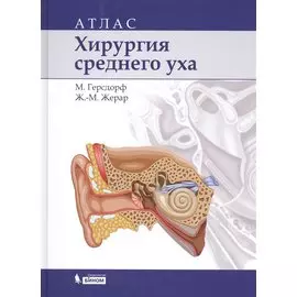 Хирургия среднего уха: атлас