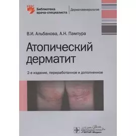 Атопический дерматит