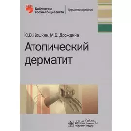 Атопический дерматит