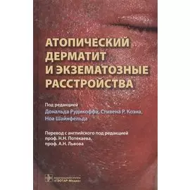 Атопический дерматит и экзематорные расстройства