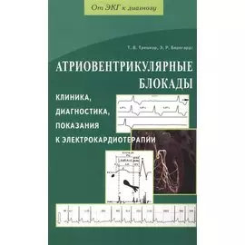 Атриовентрикулярные блокады. Клиника, диагностика, показания к электрокардиотерапии