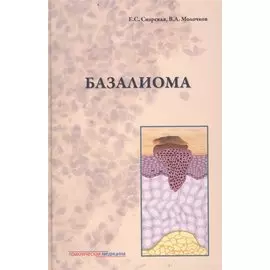 Базалиома (Снарская)