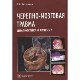 Черепно-мозговая травма. Диагностика и лечение