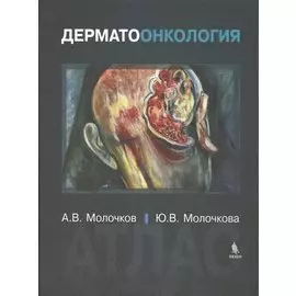 Дерматоонкология. Атлас