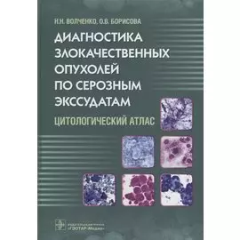 Диагностика злокачественных опухолей по серозным экссудатам