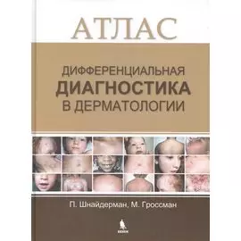 Дифференциальная диагностика в дерматологии. Атлас