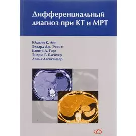 Дифференциальный диагноз при КТ и МРТ