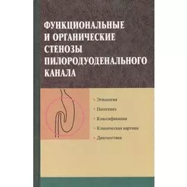 Функциональные и органические стенозы пилородуоденального канала