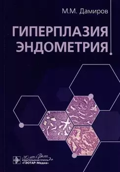 Гиперплазия эндометрия