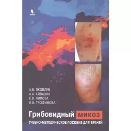 Грибовидный микоз. Учебно-методическое пособие для врачей