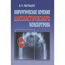 Хирургическое лечение диспластического коксартроза