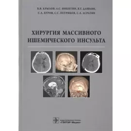 Хирургия массивного ишемического инсульта