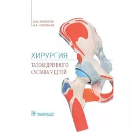 Хирургия тазобедренного сустава у детей