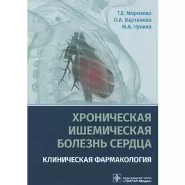 Хроническая ишемическая болезнь сердца. Клиническая фармакология
