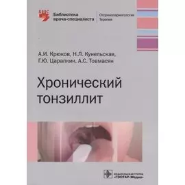 Хронический тонзиллит