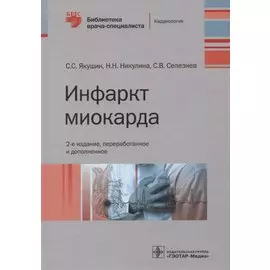 Инфаркт миокарда