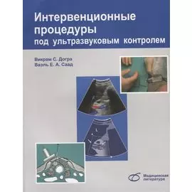 Интервенционные процедуры под ультразвуковым контролем (м) Догра