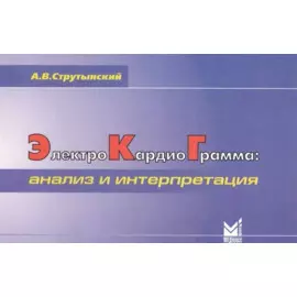 Электрокардиограмма: анализ и интерпретация