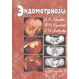 Эндометриозы. Руководство для врачей