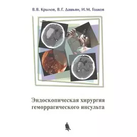 Эндоскопическая хирургия геморрагического инсульта