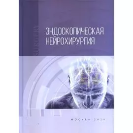 Эндоскопическая нейрохирургия