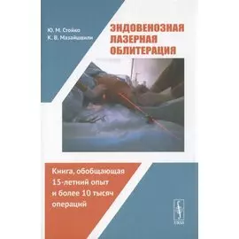 Эндовенозная лазерная облитерация